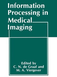 Information Processing in Medical Imaging