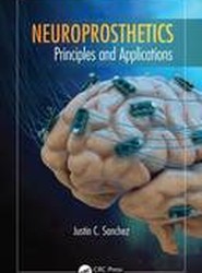 Neuroprosthetics
