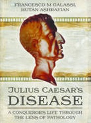 Julius Caesar's Disease