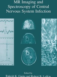 MR Imaging and Spectroscopy of Central Nervous System Infection