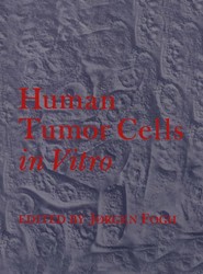 Human Tumor Cells in Vitro
