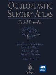 Oculoplastic Surgery Atlas