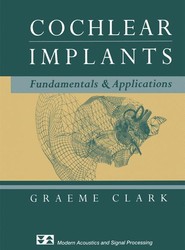 Cochlear Implants