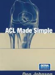 ACL Made Simple