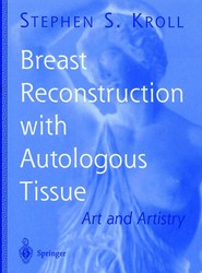 Breast Reconstruction with Autologous Tissue