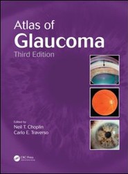 Atlas of Glaucoma
