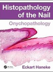 Histopathology of the Nail