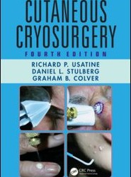 Cutaneous Cryosurgery