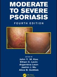 Moderate to Severe Psoriasis