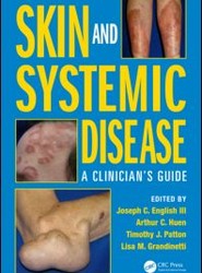 Skin and Systemic Disease