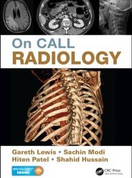 On Call Radiology