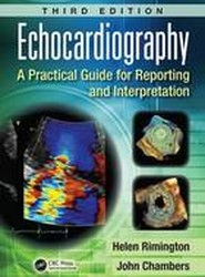 Echocardiography