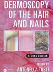 Dermoscopy of the Hair and Nails