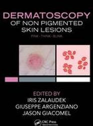 Dermatoscopy of Non-Pigmented Skin Tumors