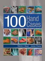 100 Hand Cases