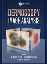 Dermoscopy Image Analysis