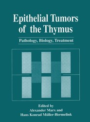 Epithelial Tumors of the Thymus
