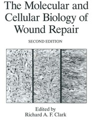 The Molecular and Cellular Biology of Wound Repair