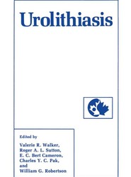 Urolithiasis