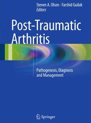Post-Traumatic Arthritis