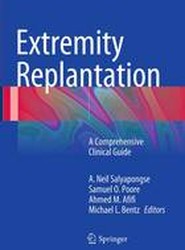 Extremity Replantation