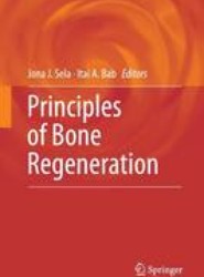 Principles of Bone Regeneration