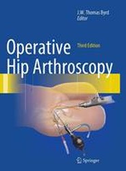 Operative Hip Arthroscopy