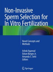 Non-Invasive Sperm Selection for In Vitro Fertilization