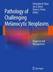 Pathology of Challenging Melanocytic Neoplasms
