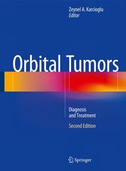 Orbital Tumors