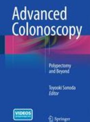 Advanced Colonoscopy