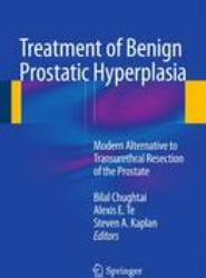 Treatment of Benign Prostatic Hyperplasia: Modern Alternative to Transurethral Resection of the Prostate