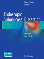 Endoscopic Submucosal Dissection