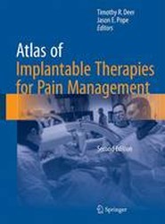 Atlas of Implantable Therapies for Pain Management
