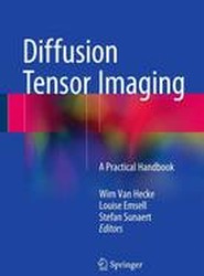Diffusion Tensor Imaging