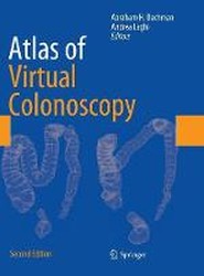 Atlas of Virtual Colonoscopy