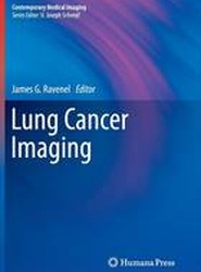 Lung Cancer Imaging