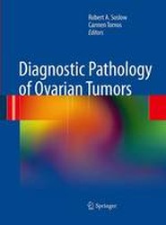 Diagnostic Pathology of Ovarian Tumors