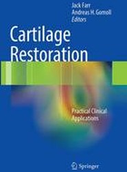 Cartilage Restoration