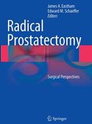Radical Prostatectomy