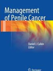 Management of Penile Cancer
