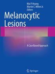 Melanocytic Lesions