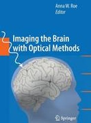 Imaging the Brain with Optical Methods