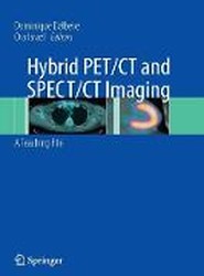 Hybrid PET/CT and SPECT/CT Imaging