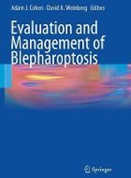 Evaluation and Management of Blepharoptosis