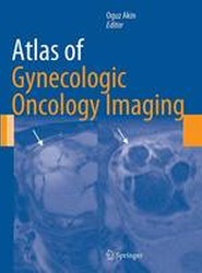 Atlas of Gynecologic Oncology Imaging