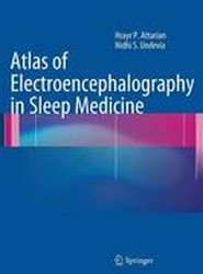 Atlas of Electroencephalography in Sleep Medicine