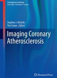 Imaging Coronary Atherosclerosis