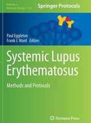 Systemic Lupus Erythematosus
