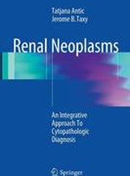 Renal Neoplasms